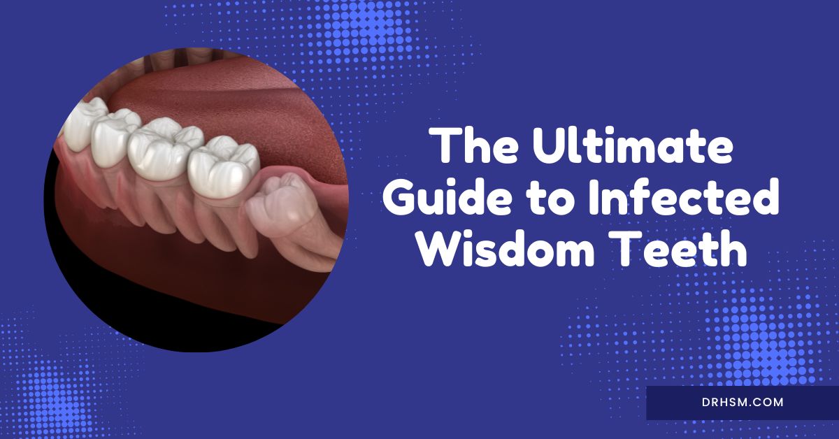 The Ultimate Guide To Infected Wisdom Tooth | Harpreet Singh Manaktala