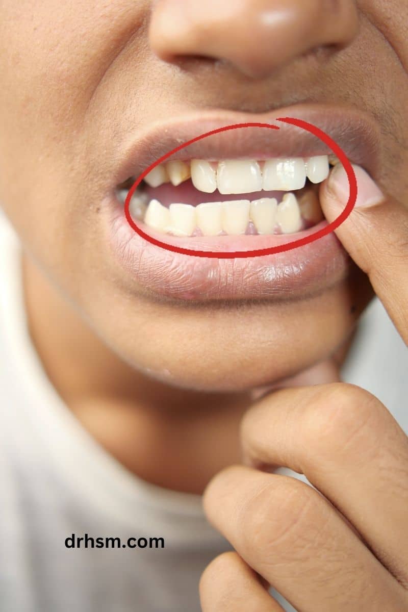 Will teeth sensitivity go away?